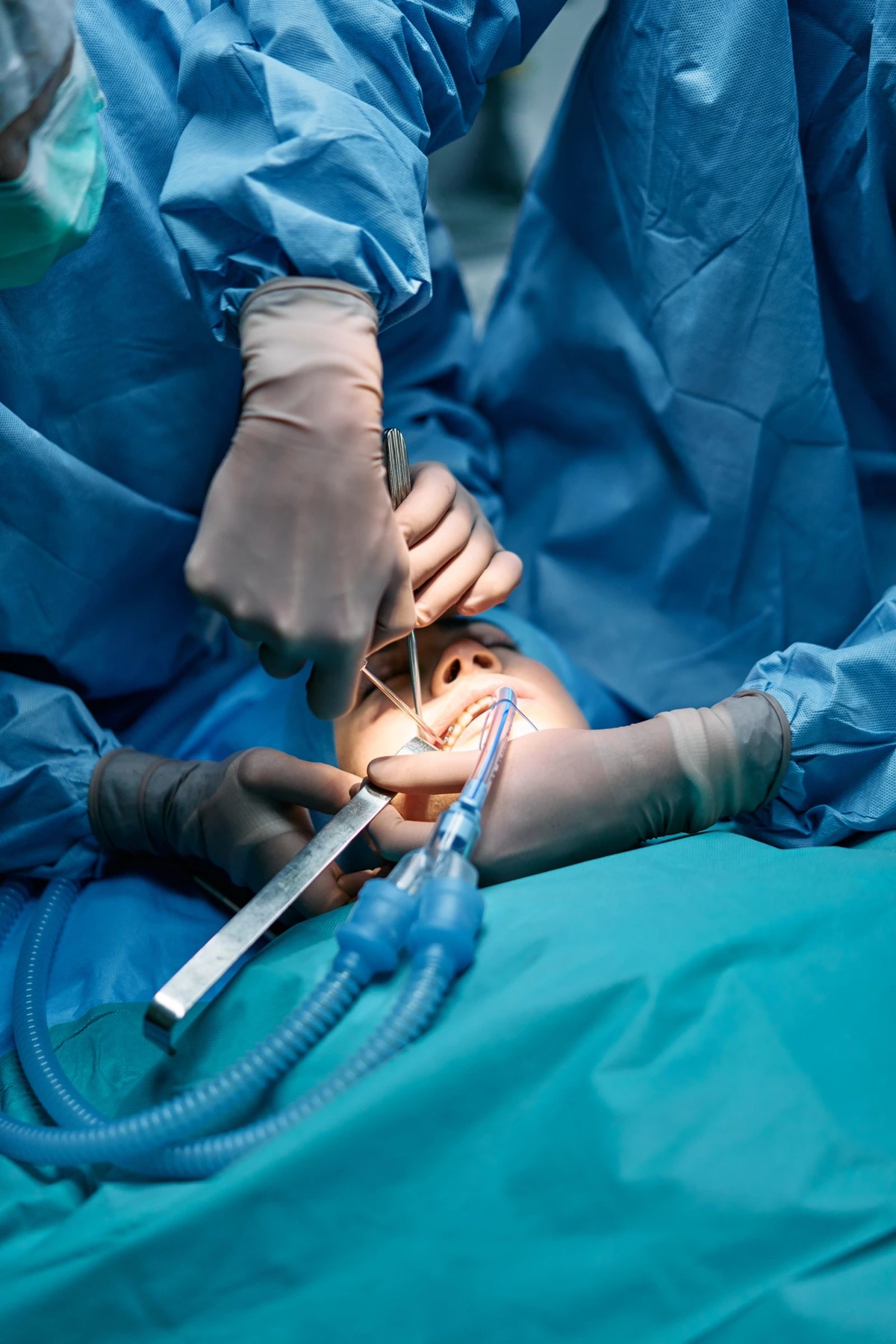 Dental clinicians working during a surgical procedure