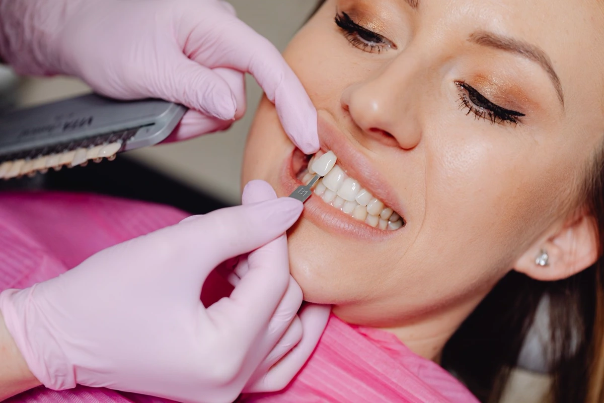 Dentist positioning a tooth-coloured veneer